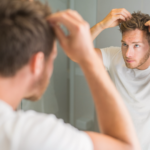 TRT Cause Hair Loss